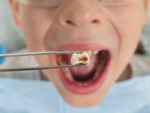 Best Teeth Whitening  in Alamo, CA