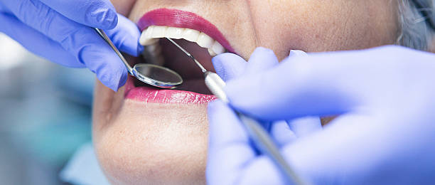 Best Dentist for Tooth Abscess  in Alamo, CA